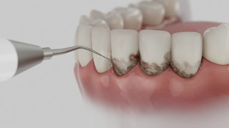 Trusted Wisdom Tooth Removal service in Edinburg, TX - Dentist Open Now
